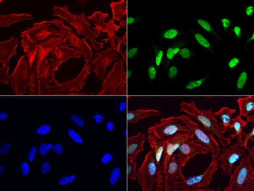 MLH1 Antibody (aa299-527, clone UMAB191)