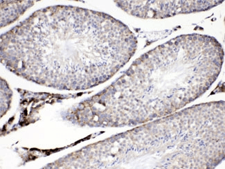 PLIN2 / ADFP / Adipophilin Antibody