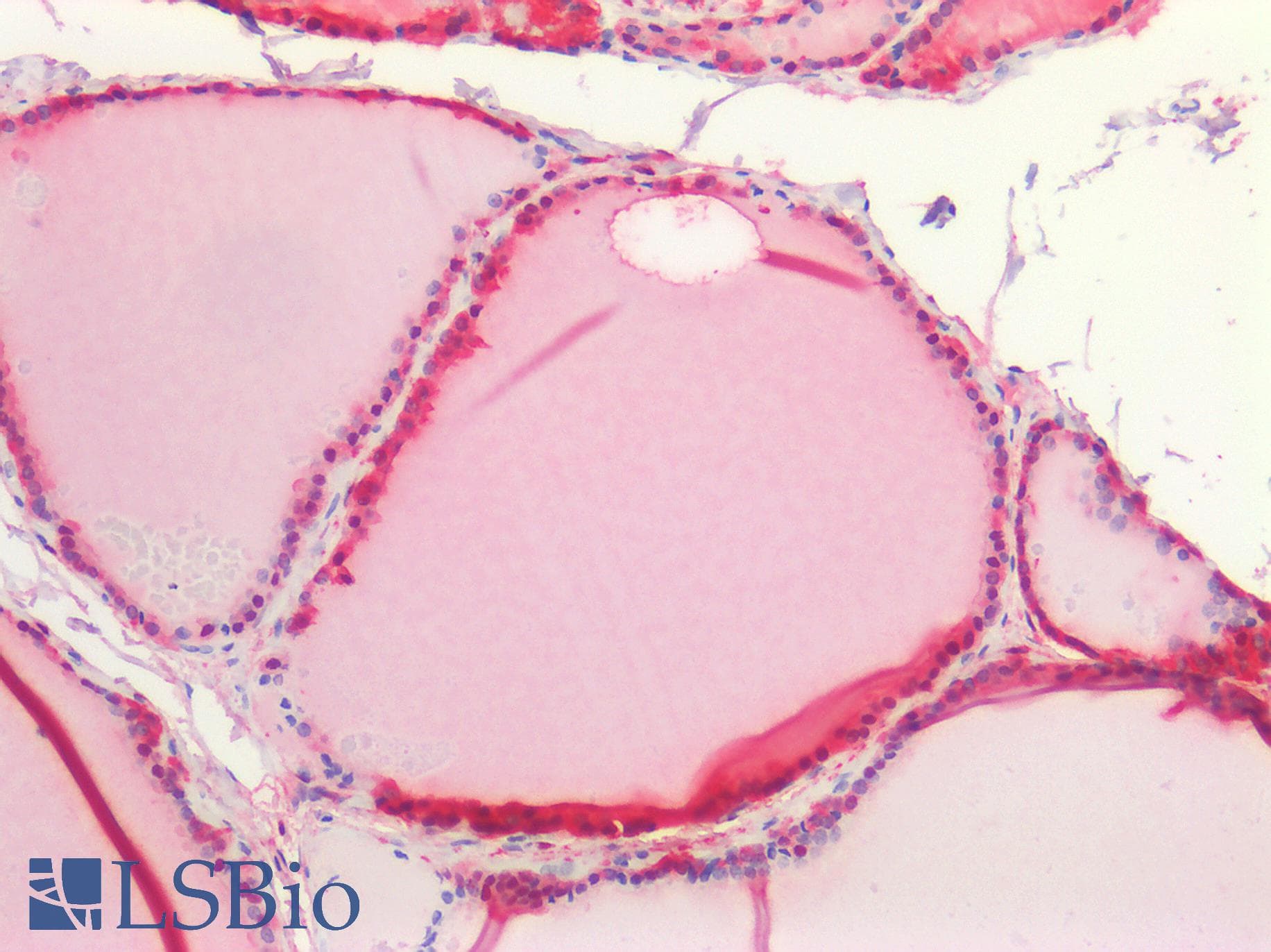 PathPlus™ ALDH1A1 / ALDH1 Antibody (clone 1G6)