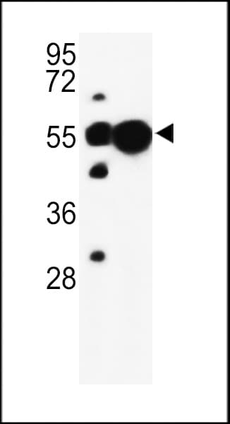 NAG20 / UBAP1 Antibody (aa6-33)