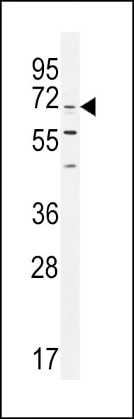 Polyclonal Rabbit anti-Human CPSF3L Antibody (aa91-119, IHC, IF, WB)