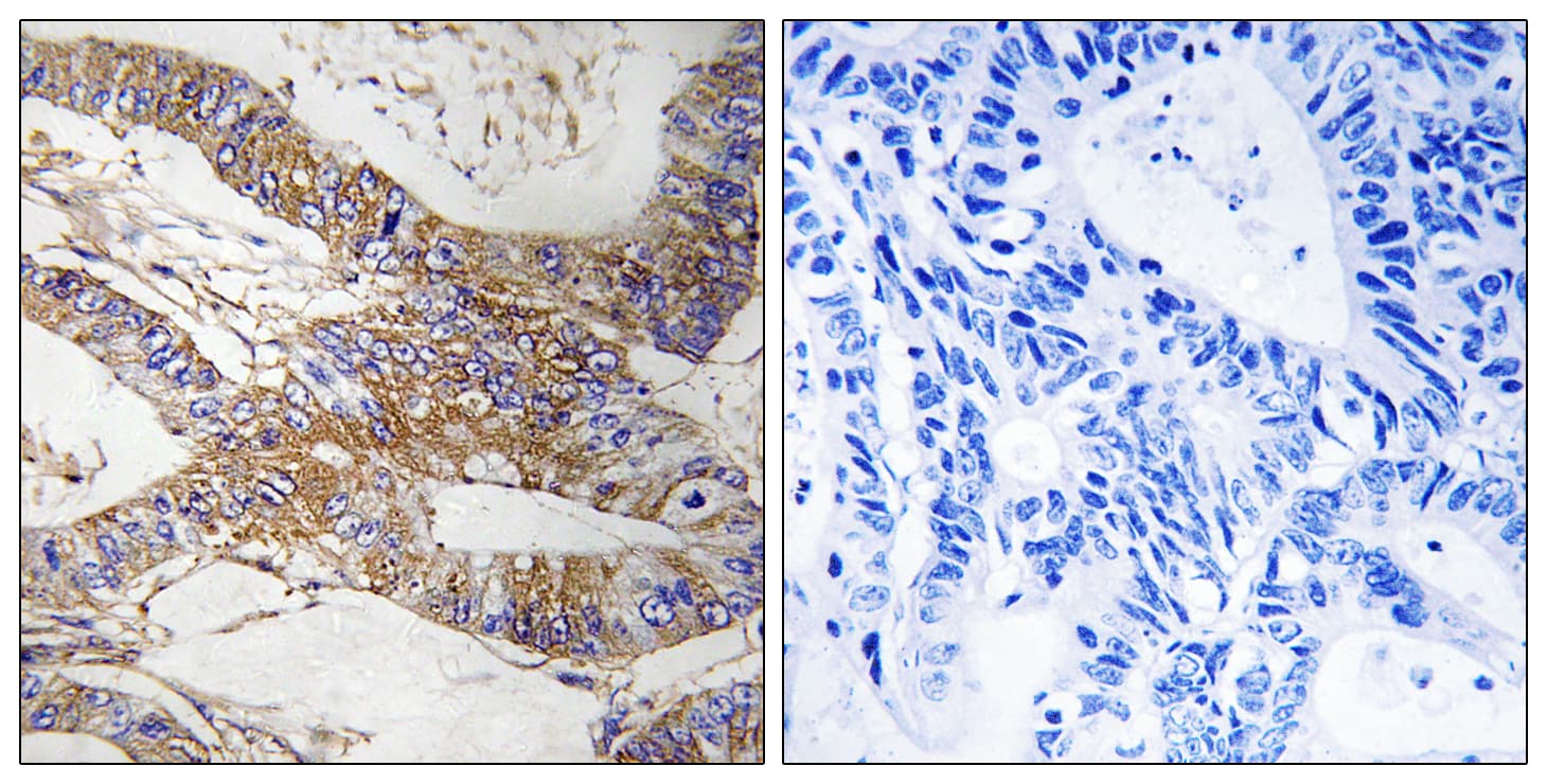 Polyclonal Rabbit anti-Human SERPINB9 / PI9 Antibody (aa241-290, IHC, WB)