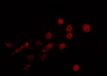 Polyclonal Rabbit anti-Human HFH-4 / FOXJ1 Antibody (IHC, IF, WB)