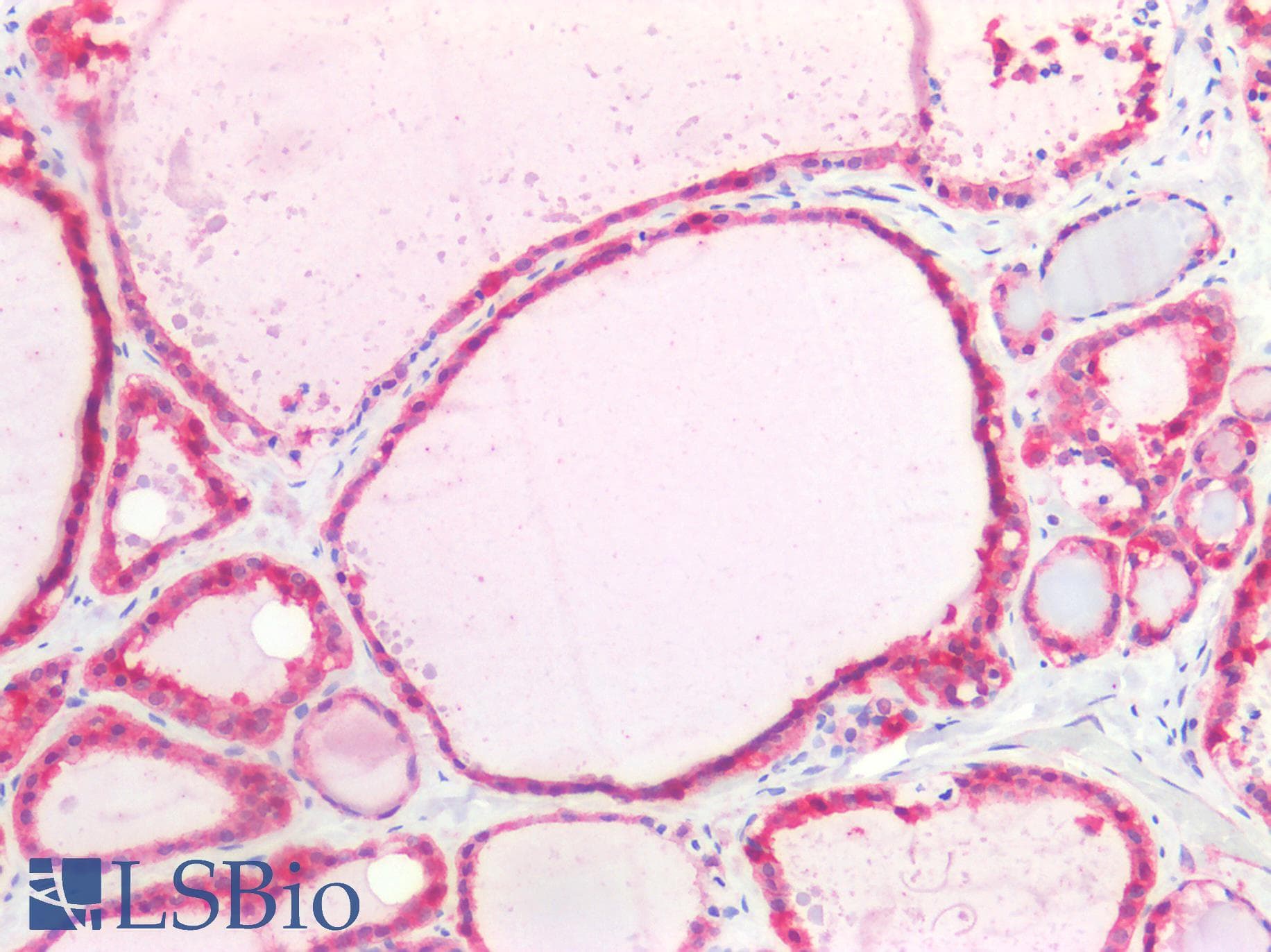 PathPlus™ OCLN / Occludin Antibody (C-Terminus)