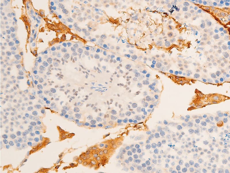 Polyclonal Rabbit anti-Human NFKBIE / IKB Epsilon Antibody (phospho-Ser22, IHC, IF, WB)