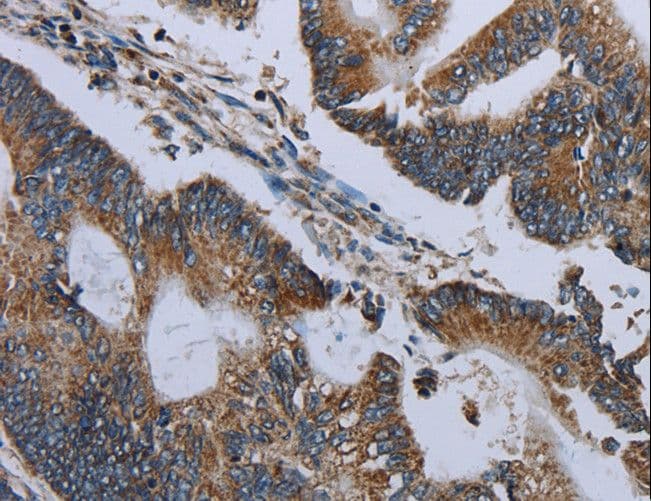 NDUFA13 / GRIM19 Antibody