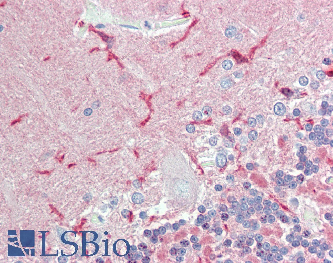 IHC-plus™ Polyclonal Rabbit anti-Human CADM2 Antibody (Internal, IHC)