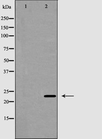 Polyclonal Rabbit anti-Human CD8B / CD8 Beta Antibody (IHC, WB)
