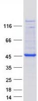 Human FBXO2 Protein (Recombinant Myc-DDK (Flag))