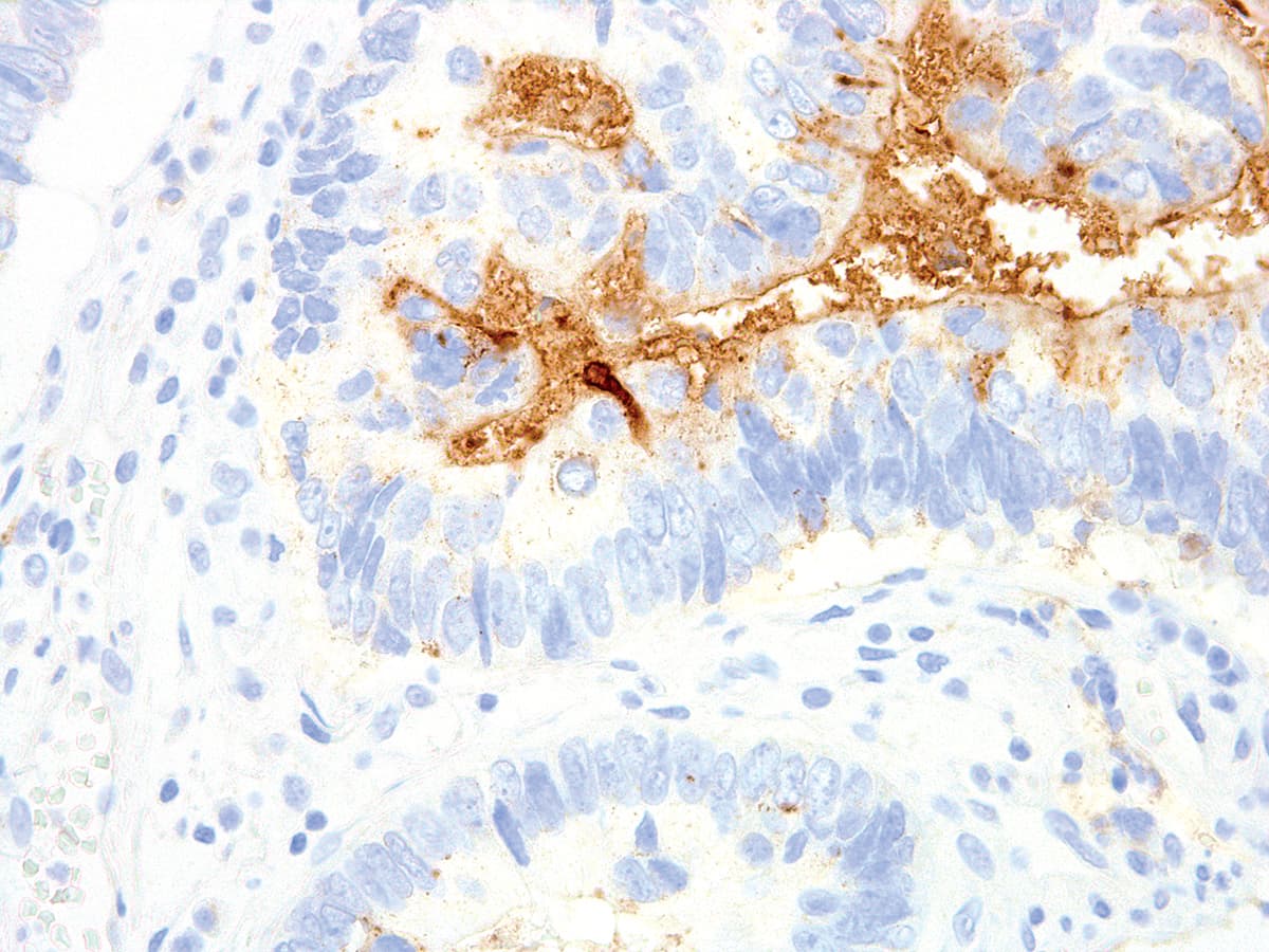 TAG-72 Antibody (Ready-to-Use)