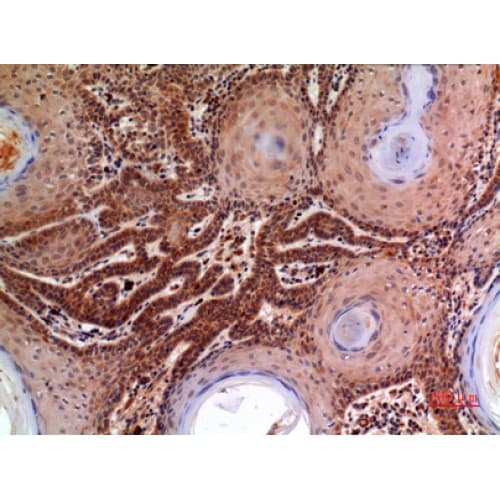 A2M / Alpha-2-Macroglobulin Antibody (Internal)