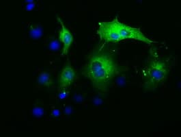 IHC-plus™ PAICS / ADE2 Antibody (clone 1B4)