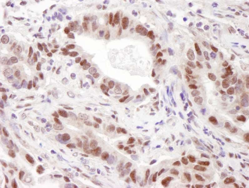 PRMT4 / CARM1 Antibody (aa450-500)