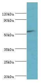 CD119 / IFNGR1 Antibody (aa270-489)