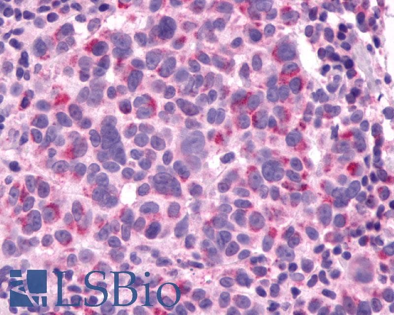 IHC-plus™ Polyclonal Rabbit anti-Human GCGR / Glucagon Receptor Antibody (N-Terminus, IHC)