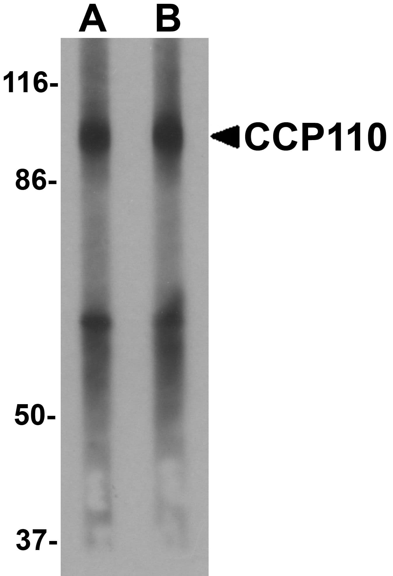 IHC-plus™ CCP110 Antibody