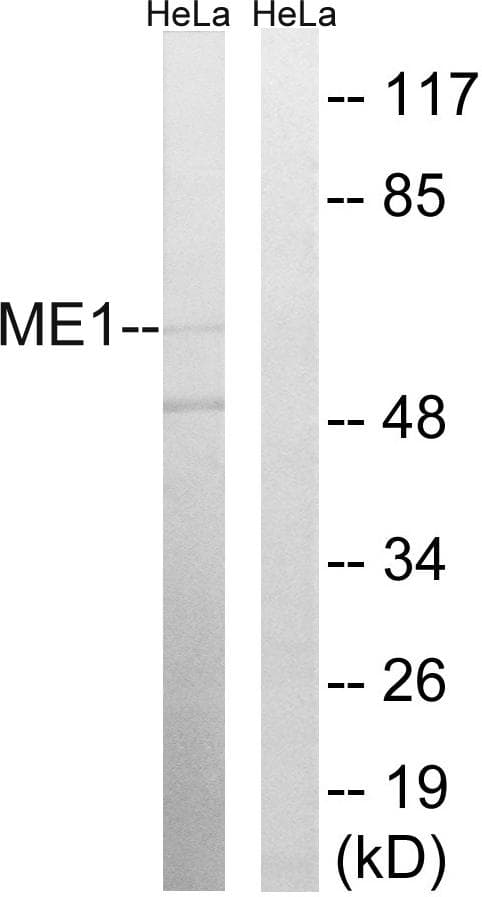 ME1 / Malate Dehydrogenase Antibody
