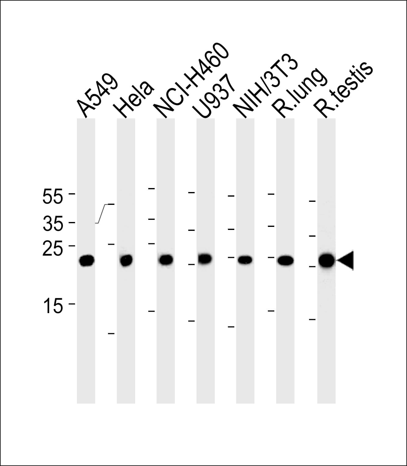 C/EBP Delta / CEBPD Antibody (aa161-189)