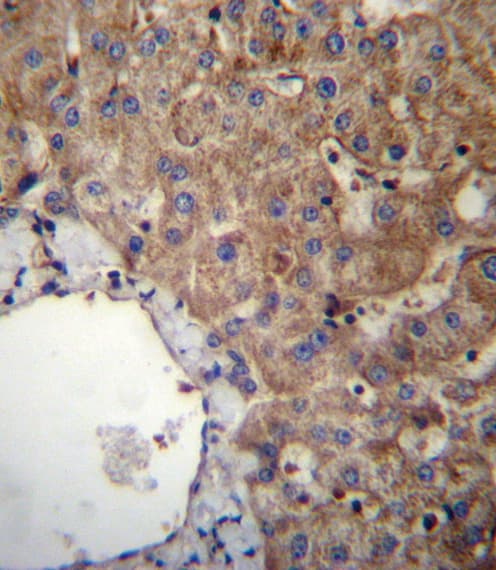 Polyclonal Rabbit anti-Human SLC23A1 / SVCT1 Antibody (aa1-30, IHC, WB)