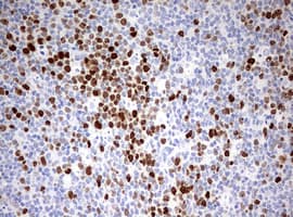 TOP2A / Topoisomerase II Alpha Antibody (aa1100-1531, clone OTI1D5)