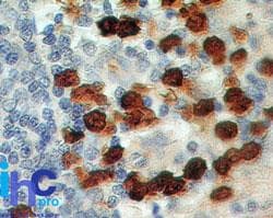 S100A8 / MRP8 Antibody (aa2-105, clone 48M7F9)