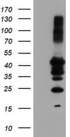 Monoclonal Mouse anti-Human PTP1B Antibody (clone OTI1C5, IHC, WB)