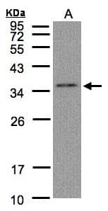 Polyclonal Rabbit anti-Human HC71 / GLOD4 Antibody (aa5-217, IHC, WB)