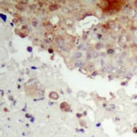 NFKBIE / IKB Epsilon Antibody (phospho-Ser22)