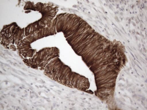 KRT18 / CK18 / Cytokeratin 18 Antibody (aa69-372, clone OTI2H10)