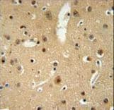 NMB / Neuromedin B Antibody (aa15-42)