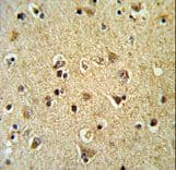 PPID / Cyclophilin D Antibody (aa85-115)