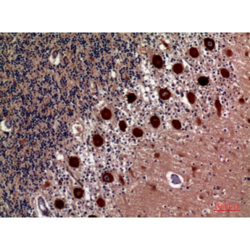 HSD11B1 / HSD11B Antibody (1-50 aa, N-terminal)