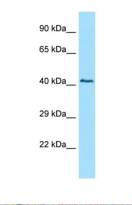 SNTA1 / Syntrophin Alpha 1 Antibody (aa92-141)