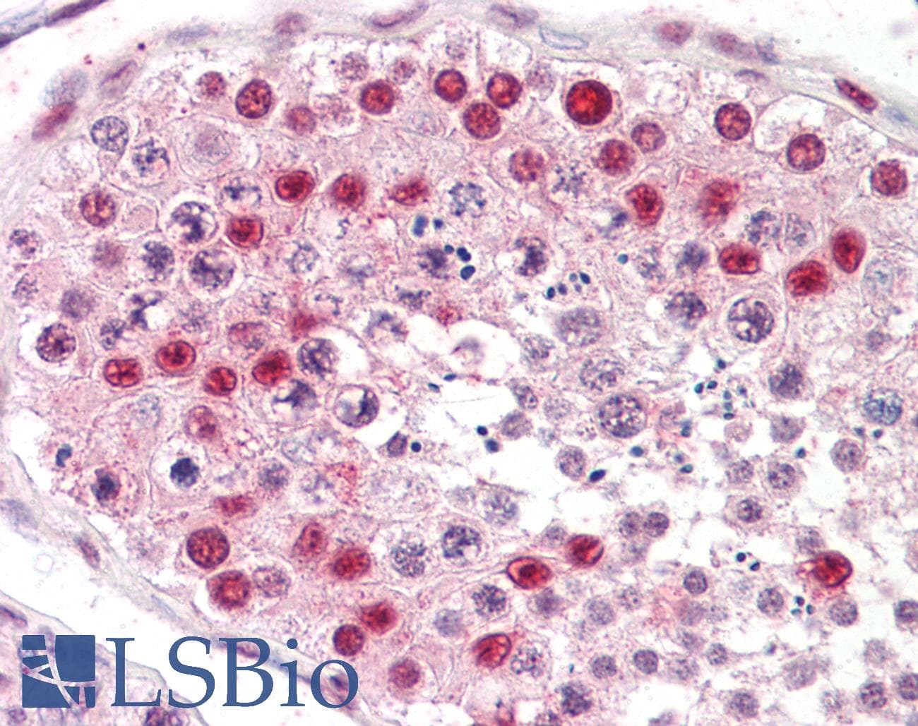 IHC-plus™ TSPY1 / TSPY Antibody
