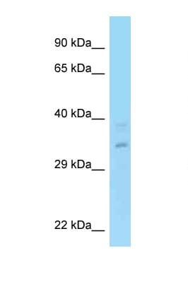 Polyclonal Rabbit anti-Human RPRD1A Antibody (aa79-128, WB)