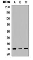 Polyclonal Rabbit anti-Human HLA-DQB1 Antibody (Internal, WB)