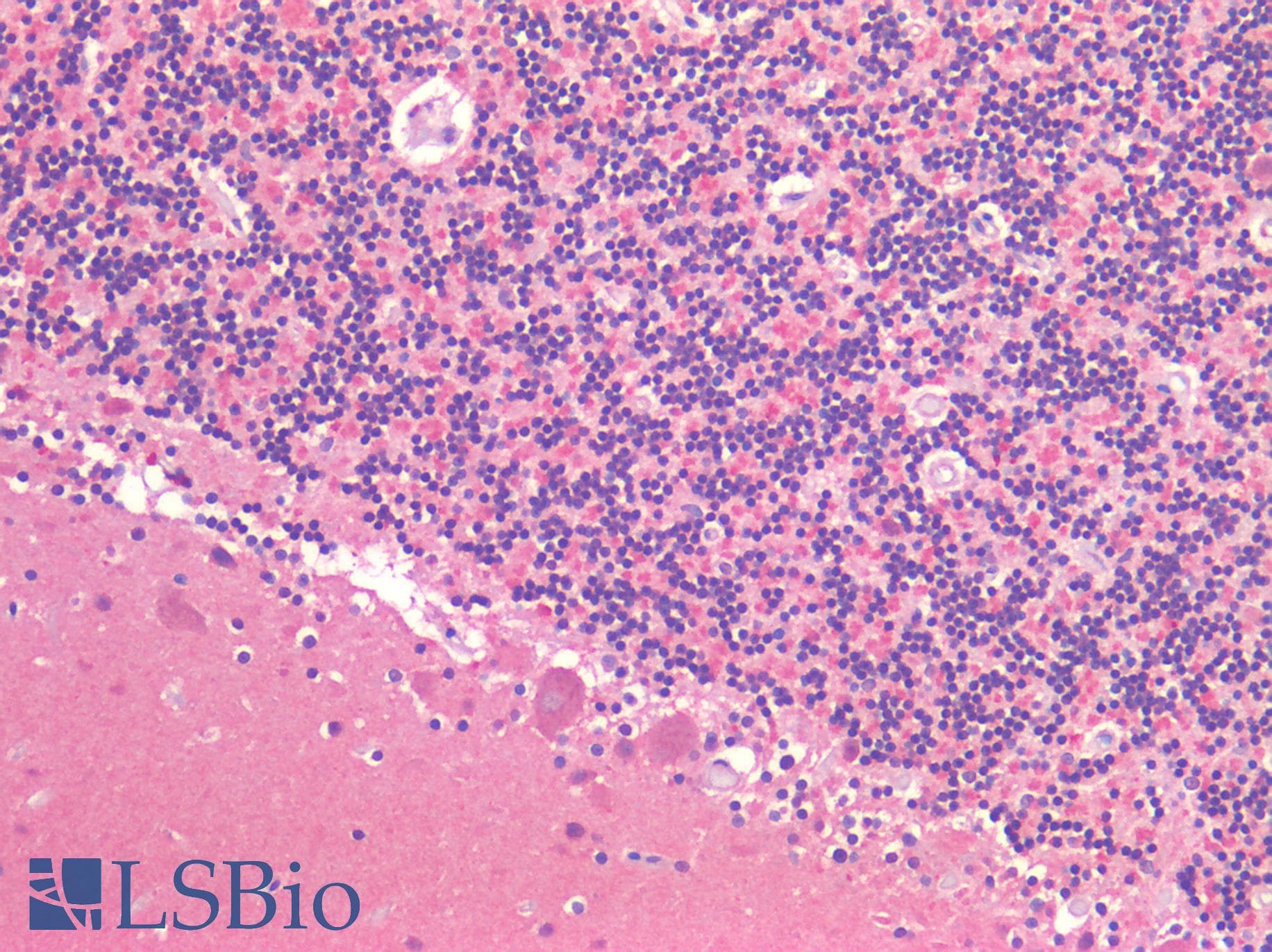 IHC-plus™ Polyclonal Rabbit anti-Human IGF1R / IGF1 Receptor Antibody (IHC)