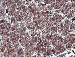 SERPINB1 Antibody (clone OTI4B3)