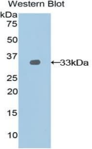 NEXN / Nexilin Antibody (aa214-455, HRP)