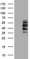 DTNB / Dystrobrevin Beta Antibody (clone OTI3H8)