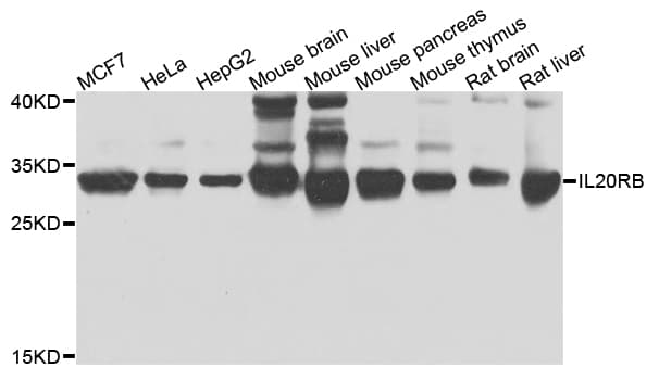 Polyclonal Rabbit anti-Human IL20RB Antibody (WB)