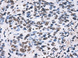 HDAC10 Antibody (clone OTI3C2)