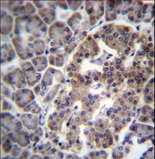 DNAJC14 Antibody (aa184-213)