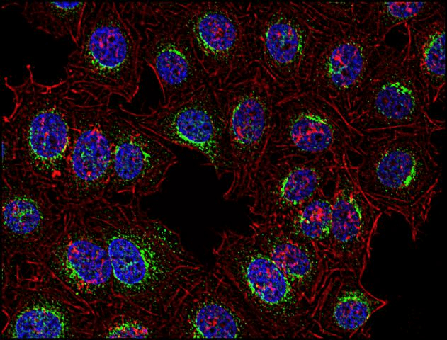IHC-plus™ SYK Antibody (aa5-360, clone SYK-01)