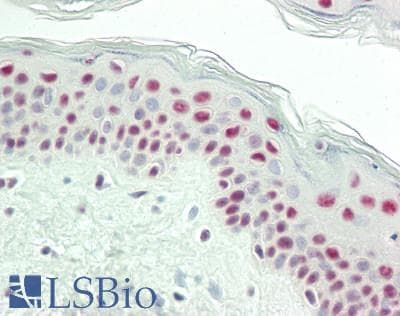 IHC-plus™ BTF / BCLAF1 Antibody (aa150-200)