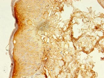 LSMEM2 / C3orf45 Antibody