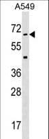 STK35 Antibody (aa374-404)