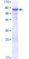 Human NAG20 / UBAP1 Protein (Recombinant GST)