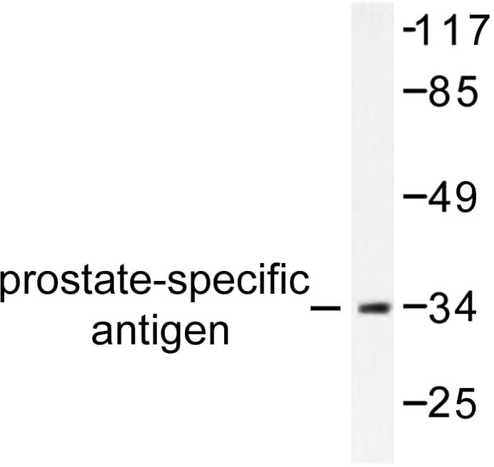 KLK3 / PSA Antibody (Leu106)