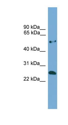 ETHE1 Antibody (aa92-141)
